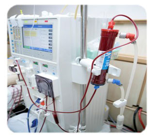 血液透析設備